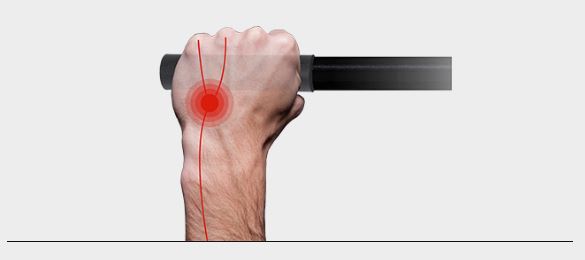Excessive pressure example Excessive pressure example